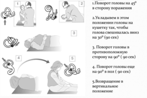Причины, симптомы и лечение головокружения